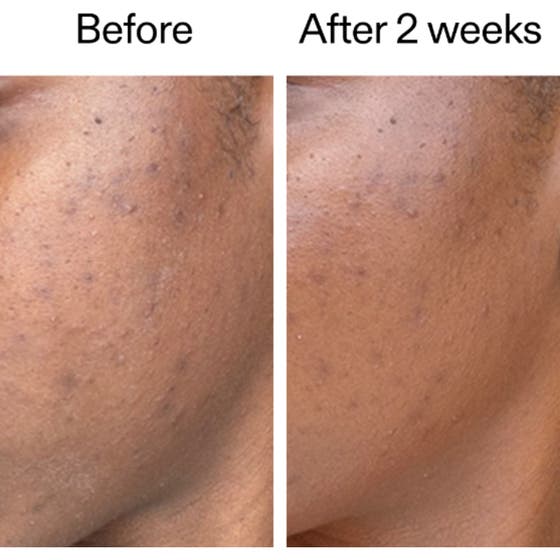 360 Skin Clearing Serum