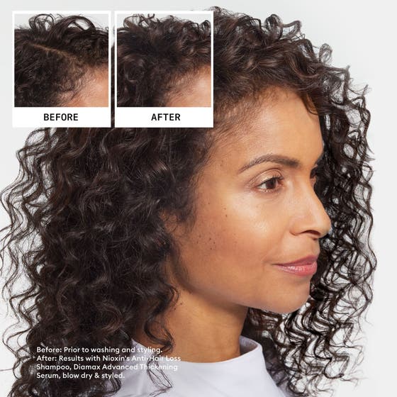 Hairloss Defense System