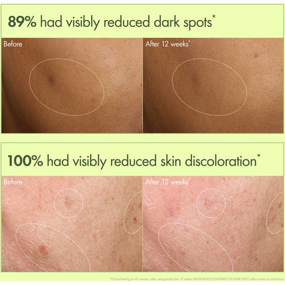 Dr. Weil Mega-Mushroom Dark Spot Brightening Serum