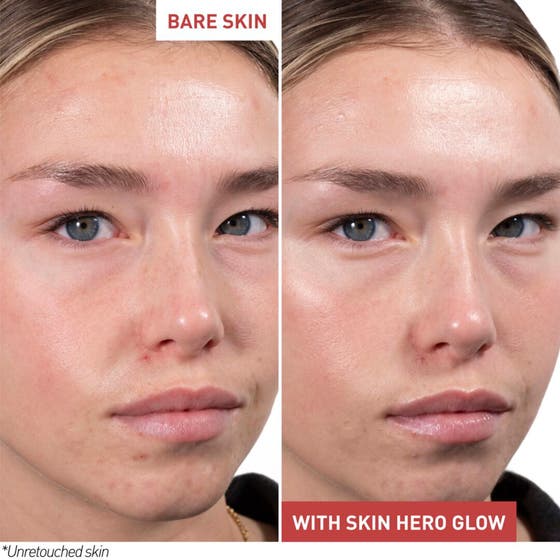 Skin Hero Glow