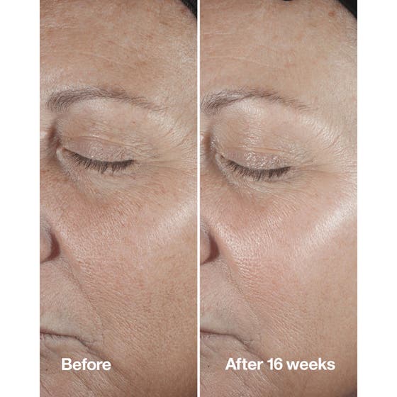 Serum Starters - Introduktion till Serum för Män som Vill Boosta sin Hudvård