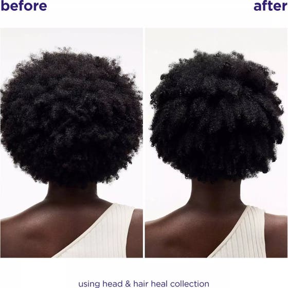 Beauty Box AW26 Head & Hair Heal