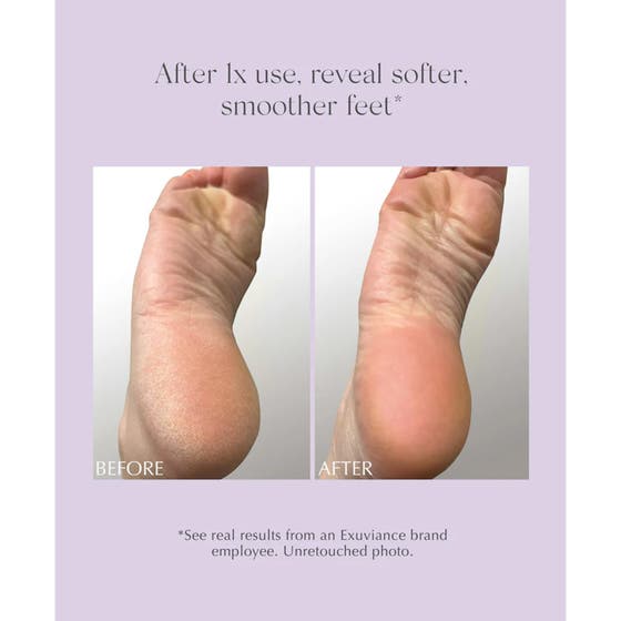 Exfoliating & Conditioning Foot Balm