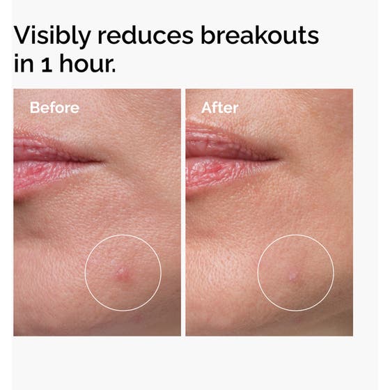 Sulfur 10% Powder-To-Cream Concentrate