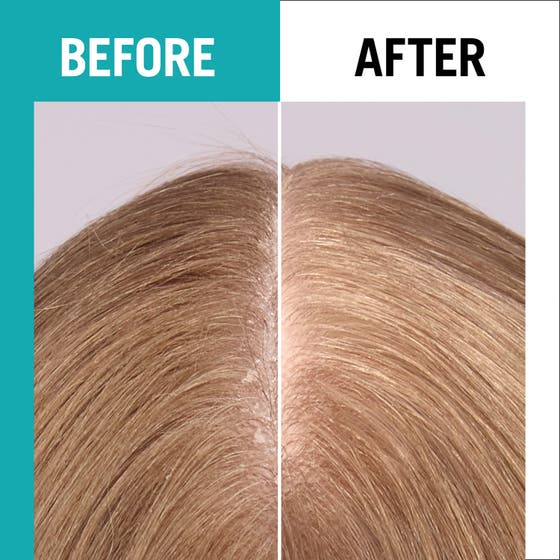 Gliss Scalp Balance Gentle Shampoo